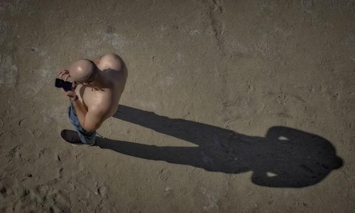 Kopaszodás és férfikép